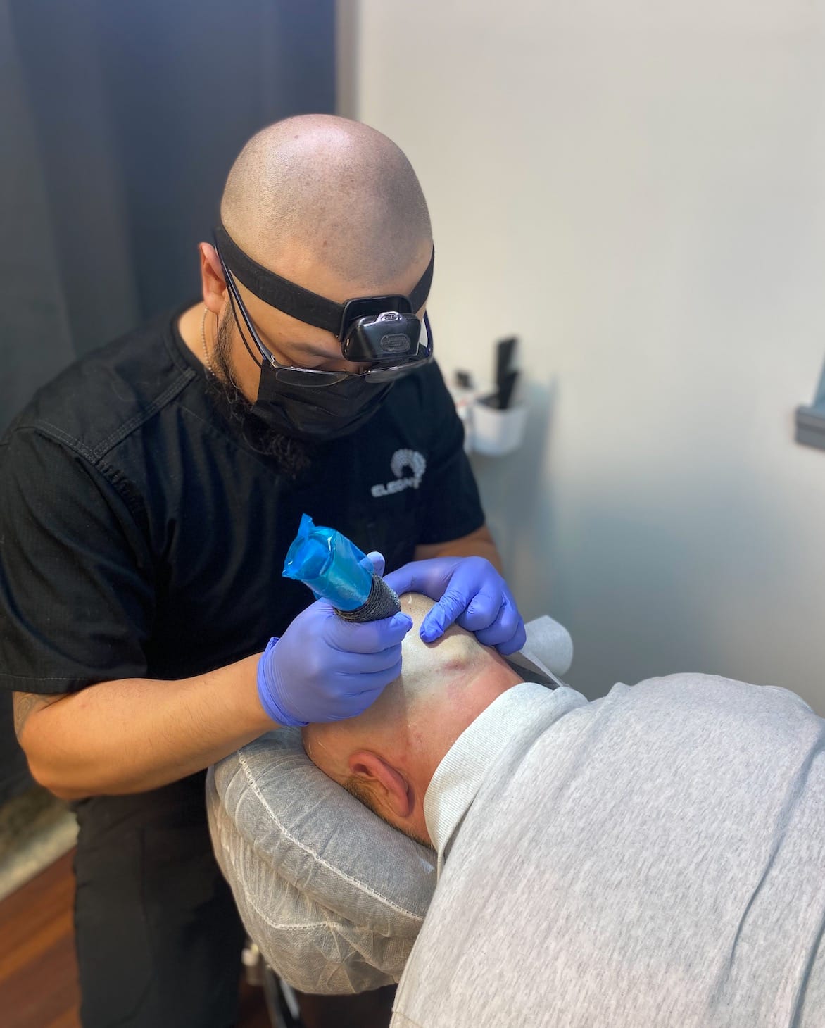 Why Scalp Micropigmentation Fades and Effective Ways to Combat It