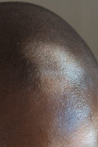 The Best Matte Product for Scalp Micropigmentation